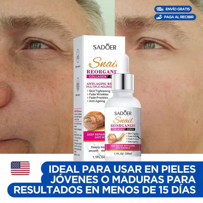 Serum Facial de Baba de Caracol🔥Despigmentante de manchas e imperfecciones en el rostro de manera natural